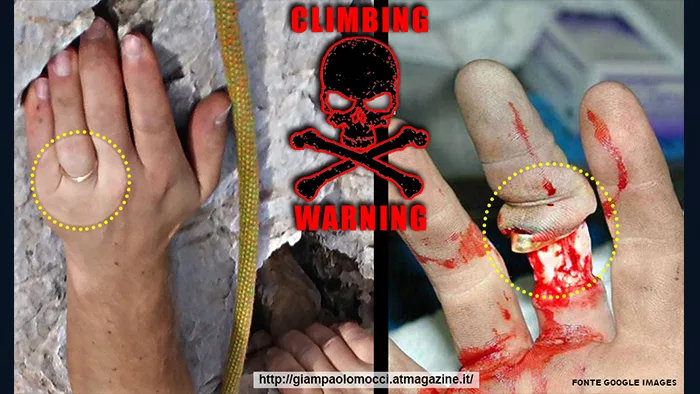 Conseguenze dell'uso degli anelli in arrampicata